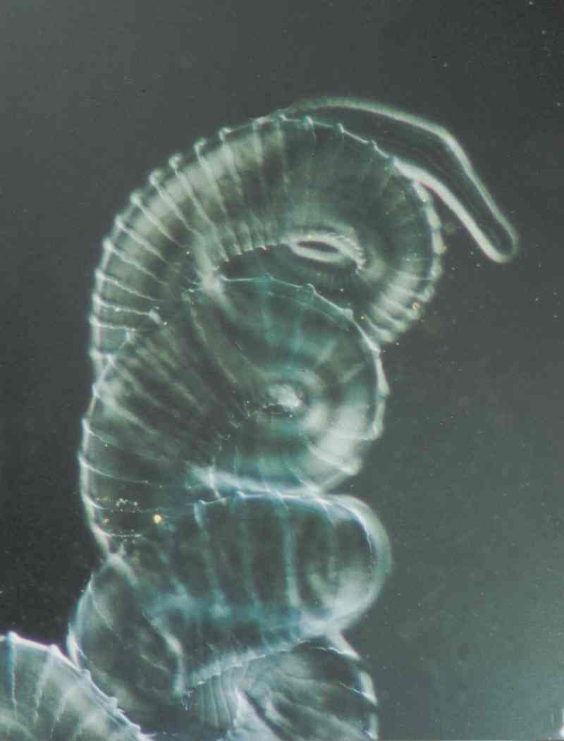 Onchocerca gutturosa male (A. Renz)