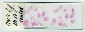 No 17-post-mortem-slide-komp