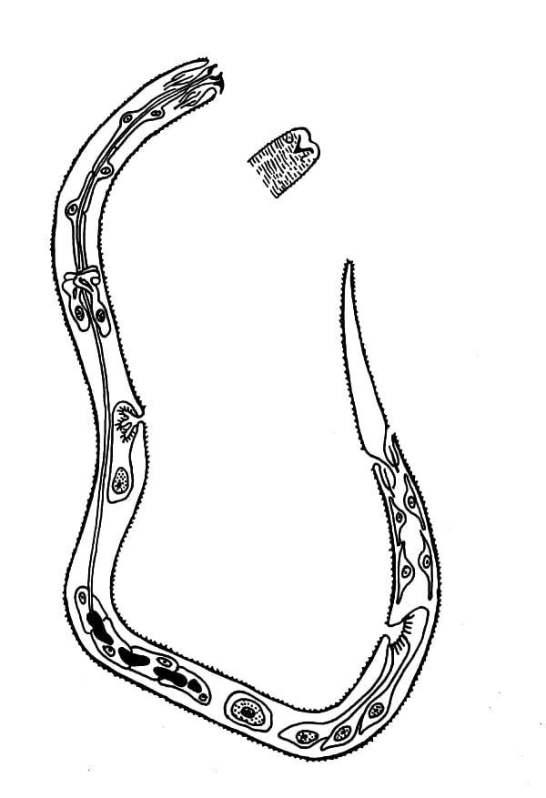 Microfilaria-EM-Renz-Wenk