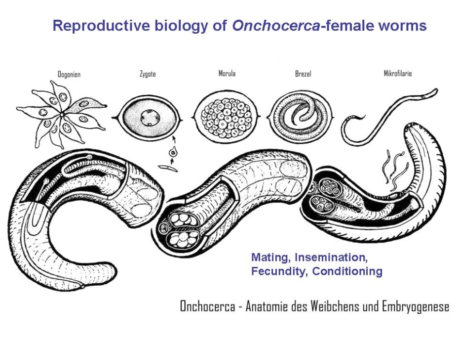 female Onchocerca adult worm (A. Renz, original)